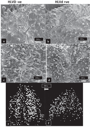 Fig. 8 Scanning electron microscopic images of bracts of cannabis genotype ‘Headband’ from a healthy plant (a, c, e) compared to an HLVd-infected plant (b, d, f). In (a, b) the upper bract surface shows well developed stalked trichomes with large heads (a) compared to the stunted development of trichomes on a diseased bract (b). In (c, d), higher magnification views of the lower bract surface of healthy (c) and diseased (dt) plants shows the reduced stalk length and head size resulting from viroid infection. (e, f) Computer-derived image analysis in which trichome segmentation was performed to represent the glandular heads by white circles, showing that the size of glandular heads but not the density of trichomes was reduced as a result of HLVd infection (f) compared to a healthy sample (e).