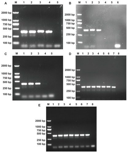 Figure 2 The effects of PEI-based derivatives on the nonspecific polymerase chain reaction (PCR) system. Lane M is the DL 2000 marker, and the rightmost lane in each panel is the negative control amplified without template and additives. (A) PEI was added into the PCR mixture. From lane 1 to 4, its final concentration is 0, 20, 40, 60 μg/L, respectively. (B) PEI-Ac50 was added into the PCR mixture. From lane 1 to line 5, its final concentration is 0, 45, 90, 112, and 135 μg/L, respectively. (C) PEI-Ac was added into the PCR mixture. From lane 1 to 4, its final concentration is 0, 36, 360, and 720 μg/L, respectively. (D) PEI-SAH was added into the PCR mixture. From lane 1 to 7, its final concentration is 0, 17, 34, 102, 170, 238, and 340 mg/L, respectively. (E) PEI-PEG-Ac was added into the PCR mixture. From lane 1 to 7, its final concentration is 0, 16.4, 32.8, 65.6, 84, 131, and 164 mg/L, respectively.Abbreviations: PEI, polyethyleneimine; PEI-Ac50, partially (50%) acetylated PEI; PEI-Ac, completely acetylated PEI; PEI-SAH, negatively charged carboxyl-terminated PEI (SAH denotes succinamic acid groups); PEI-PEG-Ac, neutralized PEI modified with both polyethylene glycol and acetyl groups.