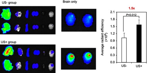 Figure 6 Evaluation of delivery efficiency using NIR-Alb NP complexes in U87 MG-Luc orthotopic mouse model. US was applied at 0.1 W/cm2 and 10% duty cycle for 5-min treatment on the right side of the brain. Fluorescence from Cy5.5 in organs and brain was detected by IVIS. Comparisons of the delivery efficiency were against the US-untreated using Student’s t-test (n=2). *P<0.05 and **P<0.005.Abbreviations: IVIS, in vivo imaging system; NIR-Alb NP, near-infrared dye-incorporated albumin nanoparticle; US, ultrasound.