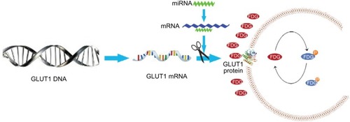 Figure 5 Models show the possible metabolic status in thyroid cancer with different miR-34a expression. miR-34a expression in ATC was lower than that in differentiated thyroid carcinoma, which cannot inhibit the GLUT1 expression, leading to increased FDG avidity. The glycolysis pathway, including 18F-FDG uptake, was upregulated in patients with ATC. Thus, SUVmax was significantly higher in patients with ATC.