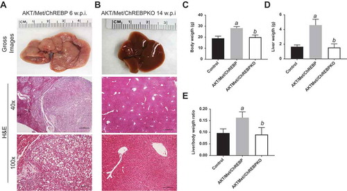 Figure 5. Genetic depletion of ChREBP abolishes AKT/Met-driven hepatocarcinogenesis in mice. (a) Overexpression of myr-AKT1 and c-Met protooncogenes promoted the development of multiple liver tumors within 6 weeks post hydrodynamic injection (w.p.i) in mice with wild-type ChREBP gene (indicated as AKT/Met/ChREBP). Macroscopically (gross images), livers of AKT/Met/ChREBP mice appeared pale, enlarged, and characterized by the presence of numerous nodules. Microscopically, the liver parenchyma of AKT/Met/ChREBP mice was occupied by numerous hepatocellular tumors (T) composed by clear cell neoplastic hepatocytes with an enlarged, clear cytoplasm due to lipid accumulation. (b) Remarkably, hepatocarcinogenesis was completely suppressed when overexpression of AKT/c-Met was conducted in CHREBP KO mice (indicated as AKT/Met/ChREBPKO). Indeed, livers of AKT/Met/ChREBPKO mice were normal both macroscopically and microscopically, indistinguishable from control livers also in terms of body (c) and liver (d) weight and, consequently, liver/body weight ratio (e). Original magnifications: 40x and 100x. Scale bar: 500µm for 40x, 100µm for 100x. Tukey–Kramer test: P < 0.0001 a, vs control (mice injected with empty vector); b, vs AKT/Met/ChREBP mice. Abbreviation: H&E, hematoxylin and eosin.