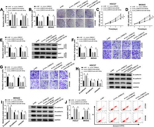 Figure 4 Circ_CORO1C exerted its oncogenic role in GC cells by directly targeting miR-138-5p. HGC-27 and MKN45 cells were transfected with si-NC, si-circ_CORO1C, si-circ_CORO1C+anti-miR-NC or si-circ_CORO1C+anti-miR-138-5p. (A) QRT-PCR assay for the relative expression of miR-138-5p in transfected cells. (B) Colony formation assay for the colony formation ability of transfected GC cells. (C and D) MTT assay for the cell viability of transfected cells. (E) Western blot assay for the protein level of Ki67 in transfected cells. (F and G) Transwell assay for the migration and invasion of transfected cells. (H and I) Western blot assay for the protein levels of E-cadherin, N-cadherin and vimentin in transfected cells. (J) Flow cytometry for the apoptotic rate of transfected cells. *P <0.05.