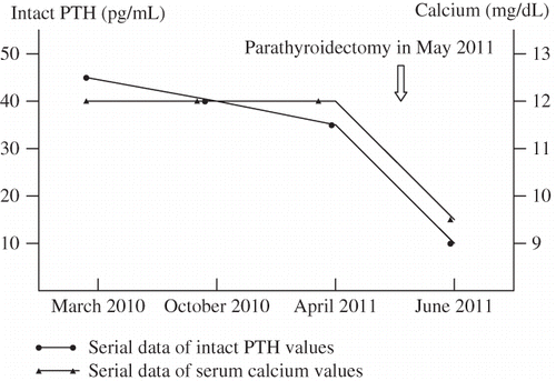 Figure 1. Serial data of intact PTH and serum calcium value.