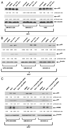 Figure 3. Proteasome inhibition with bortezomib induces functional p53 protein in HPV-positive cells but not HPV-negative cells. Three HPV-negative HNSCC cell lines (A) and three HPV-positive HNSCC cell lines (B) were left untreated, treated for 24 h with 0.1% DMSO, or treated for 24 or 48 h with 50 nM (UM-SCC-22A, UM-SCC-1, 1483, UPCI:SCC090, UM-SCC-47) or 200 nM (UD-SCC-2) bortezomib. Following treatment, immunoblotting was used to detect expression of p53, p21 and β-actin. Ratios of p53/β-actin and p21/β-actin were determined by densitometric scanning. Similar results were obtained in three independent experiments. (C) Suppression of p53 expression/activity in bortezomib-treated HPV-positive cells using p53 siRNA. HPV-positive HNSCC cells were either left untransfected or were transfected with 100 nM nonspecific siRNA or p53 siRNA. After 24 h, untransfected cells were treated with 0.1% DMSO, 50 nM (UPCI:SCC090, UM-SCC-47) or 200 nM (UD-SCC-2) bortezomib, and transfected cells were treated with bortezomib (50 or 200 nM, as above). After 48 h of treatment, immunoblotting was used to detect p53, p21, HDM2 and β-actin. Bortezomib induction of p53 and the products of p53 target genes were inhibited by p53 siRNA, but not nonspecific siRNA. The experiment was performed three times with similar results.