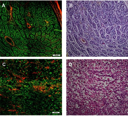 Figure 3 Comparative MPM and H&E stained images of benign testicular tissue (A and B) and rhabdomyosarcoma (C and D). Collagen fibers appear color-coded red on MPM, Tubuli seminiferi contorti (testis) and nuclei of rhabdomyoblasts and parts of myxoid stroma (rhabdomyosarcoma) appear green.Abbreviations: MPM, multiphoton microscopy; H&E,  hematoxylin-eosin; n.s., nonsignificant; HP, histopathology.