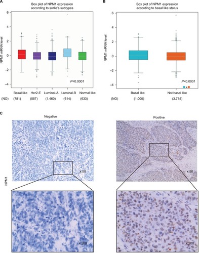 Figure 2 NPM1 was significantly highly expressed in triple-negative breast cancer and associated with active proliferation.Notes: (A) The expression of NPM1 in ER-positive and ER-negative tumors. (B) The expression of NPM1 in several subtypes of breast cancer patients. (C) Immunohistochemical analysis of NPM1 in triple-negative breast cancer patients.Abbreviations: ER, estrogen receptor; NO, number of patients.