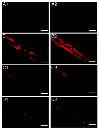 Figure 5. Fluorescence Microscopy of titanium wires. (A) uncontaminated, (B–D) incubated with 10% hamster brain homogenate infected with the 263K prion strain and treated with 224 μg mL−1 Fe3+, 500 μg mL−1 h−1 H2O2, pH = 3.5 and UV-A for 0, 240, and 480 min respectively. Each row of panels (1–2) demonstrates areas of wires of the same group. Bar: 200 μm
