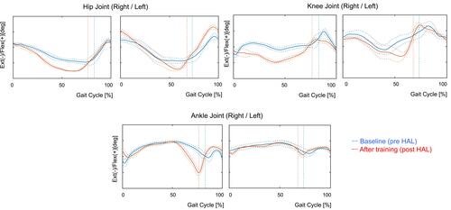 Figure 4 Temporal profile of the angular position of the hip, knee, and ankle joint over the gait cycle, measured without the HAL at baseline (pre-HAL) and after training (post-HAL). After HAL training sessions, the maximum hip and knee extension angle on both sides during the stance phases increased. Moreover, the maximum right ankle plantar flexion angle during the stance phase increased post HAL. Vertical lines indicate the moment of toe lift.