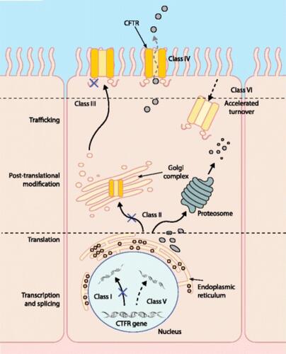 Figure 2 Schematic diagram of different CFTR mutation classes. Mutation classes I, II, V and VI result in an absence or reduced quantity of CFTR protein at the cell membrane, whereas mutation classes III and IV influence the function or activity of CFTR at the cell membrane. Potentiators increase the function of CFTR channels expressed at the apical surface of epithelial cells; for example, ivacaftor increases the probability of Gly551Asp-CFTR channel opening. Correctors improve the intracellular processing and delivery of mutant CFTR protein, allowing more to reach the cell surface; for example, tezacaftor in Phe508del-CFTR. Adapted from Brodlie M, Haq IJ, Roberts K, Elborn JS. Targeted therapies to improve CFTR function in cystic fibrosis. Genome Med. Sep 24 2015;7:101. This article is distributed under the terms of the Creative Commons Attribution 4.0 International License (http://creativecommons.org/licenses/by/4.0/).Citation87