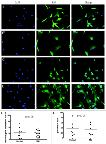 Figure 2. The expression of FAP on BMMSCs. (A) BMMSCs cell lines and (B) BMMSCs from a normal donor. (C and D) BMMSCs from MM patients at diagnosis. (E) The result of FAP expression on BMMSCs detected by qRT-PCR and (F) detected by FCM.
