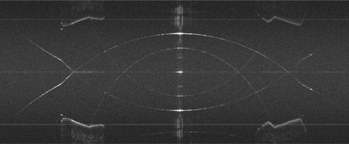 Figure 7 Cross-sectional image of a model eye (horizontal meridian) showing the complex conjugate artifact that results when full-phase SD-OCT is not performed.