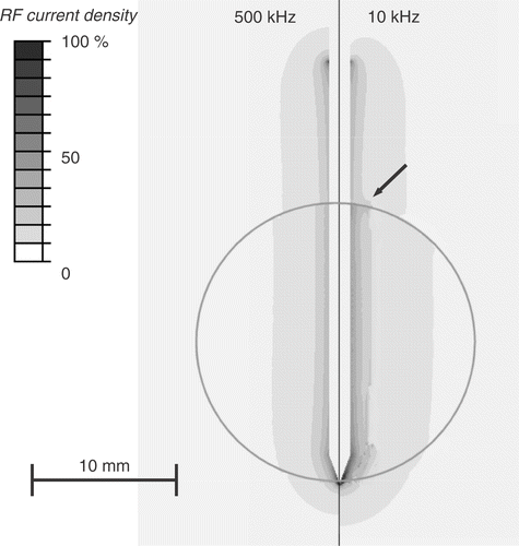 Figure 3. Electrical RF current density for cooled needle electrode, at 500 kHz (left) and 10 kHz (right) in a slice central through the electrode. At 10 kHz, current density significantly changes at tumour boundary (arrow). Current density is shown as percentage of maximum. Grey circle represents tumour boundary.
