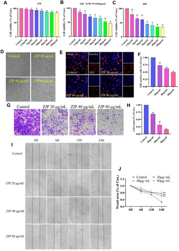 Figure 2. ZJP inhibitory effect on KYSE 150 cells. (A-C) Cell viability after treated with different concentrations of ZJP for 12, 24, and 48 h; (D) ZJP inhibitory effect on cell proliferation; (E-F) EDU staining results; (G-H) ZJP inhibitory effect on cell invasion; (I-J) ZJP inhibitory effect on cell migration. Values are expressed as mean ± SD (n = 3), #P > 0.05, *P < 0.05, **P < 0.01, compared with the control group.