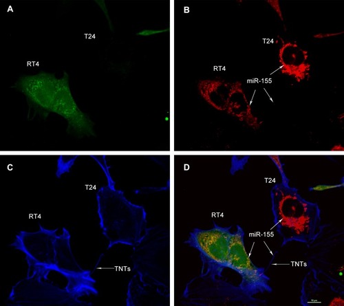 Figure 5 Intercellular transportation of miR-155 from T24 cells to RT4 cells via TNTs.Notes: RT4 cells were labeled by CFSE (A, Green), and co-cultured with T24 cells for 24 hrs. MiR-155 was labeled by the fluorescent in situ hybridization probe (B, Red). F-actin was labeled by Phalloidin-iFluor™ 405 Conjugate (C, Blue). (A, B and C) were merged as (D). Spontaneous migration of miR-155 (B and D, White arrows) from T24 to RT4 cells via TNTs (C and D) was observed by capturing “double positive” (Red and Green) RT4 cells under fluorescence microscopy (D). Bar = 10 μm.Abbreviation: miR-155, microRNA-155.