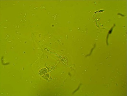 Figure 3 Clumping of lactobacilli with a matrix formation.