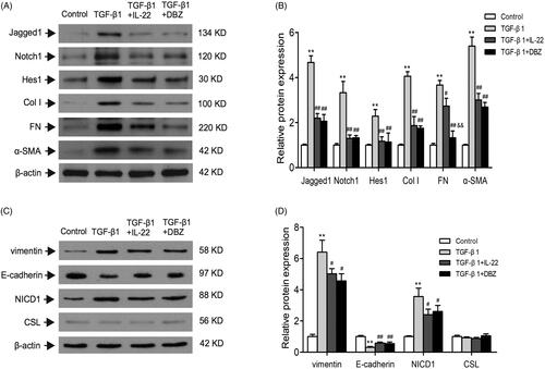 Figure 4. IL-22 reduced Notch1 pathway activation and fibrosis in HK-2 cells induced by TGF-β1. HK-2 cells were divided into four groups including control, TGF-β1, TGF-β1 + IL-22, and TGF-β1 + DBZ, the related protein levels in HK-2 cells were detected by western blot. (A) Western blot analysis of Jagged1, Notch1, Hes1, Col I, FN, and α-SMA expressions in HK-2 cells. (C) Expressions of vimentin, E-cadherin, NICD1, and CSL were determined by western blot. (B, D) Quantitative analysis of protein expressions shown in A and C. **p <.01, compared with control group; #p <.05, ##p<.01, compared with TGF-β1 group; &&p < .01, compared with TGF-β1 + IL-22 group.