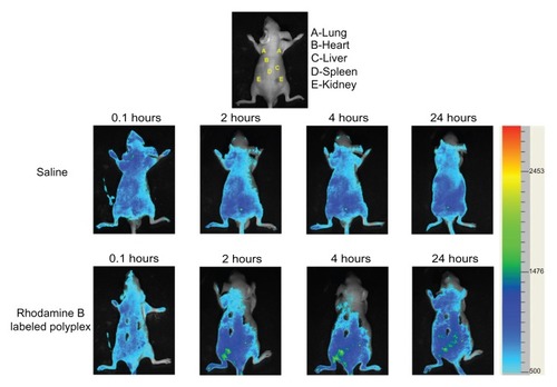 Figure 9 Biodistribution of Rhodamine B-labeled polyplexes formed from PSIA and pDNA at the polymer to gene ratio of 20 after being systemically injected in BALB/c nude-mice (saline as a control).Abbreviation: PSIA, polyspermine imidazole-4, 5-amide.