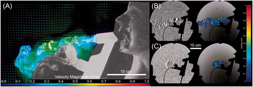 Figure 3. PIV and Schlieren visualizations of the flow structure for the unfiltered mouthpiece at six LPM. (A) PIV vector field for a normal breathing pattern. (B) Schlieren image of the flow at the same conditions showing contrast enhanced image and resulting optical flow velocity estimation and (C) Schlieren image of distressed flow at the same flow rate.