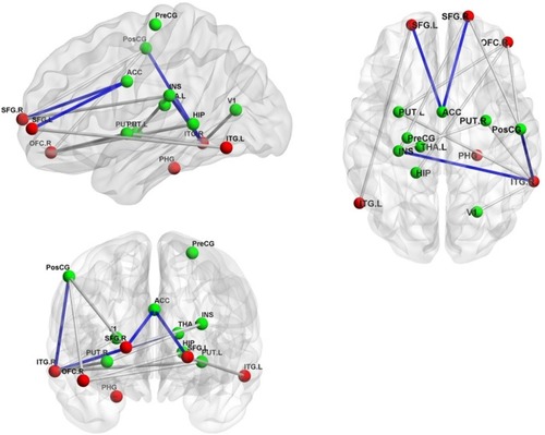 Figure 2 The pairs of regions showing the significant differences on FC or FA between the Alex group and the Cont group.