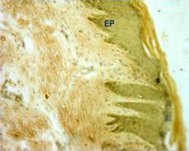 Figure 5. Skin of Bakerwali goat showing; epidermal pegs (EP) in Von Gieson and Verhoeff's X 100.