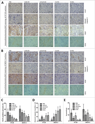 Figure 7. Immunohistochemical analysis was used to measure the effect of Bi-Ab treatment on proliferation, apoptosis and angiogenesis in vivo. In HT-29 (A) and SKOV-3 (B) tumors, proliferation and apoptosis were evaluated with Ki-67 and cleaved caspase-3 staining methods respectively, VEGF and CD31 were used to evaluate tumor angiogenesis. (C) Proliferative cells (Ki-67 positive cells) decreased in Bi-Ab-treated HT-29 and SKOV-3 tumors, and it was more effective compared to mAb-04- and cetuximab-treated tumors. (D) Apoptotic cells (cleaved caspase-3 positive cells) increased in Bi-Ab-treated HT-29 and SKOV-3 tumors. (E) The density of CD31-positive blood vessels decreased in Bi-Ab-treated HT-29 and SKOV-3 tumors. The data presented as the mean ± SD, are from a representative experiment, n = 5, *P < 0.05; **P < 0.005; ***P < 0.0005 vs. Bi-Ab treatment.