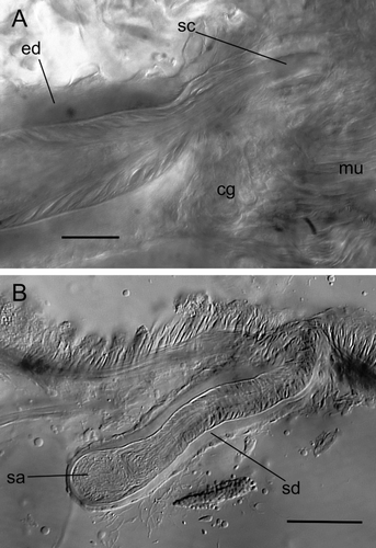 Figure 5 Photos of M. mcmurtrieae genitalia. A, Ejaculatory duct (left) entering the copulatory bursa (right) in segment XI: ed, ejaculatory duct; mu, muscle bands covering bursa; cg, copulatory gland cells; sc, sperm canal; B, spermatheca in segment X: sd, spermathecal duct; sa, spermathecal ampulla. Scales: A=30 µm; B=50 µm.