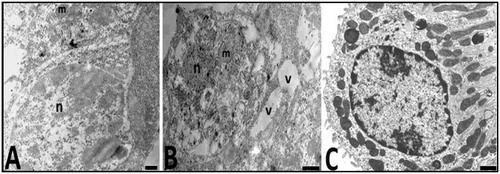 Figure 7. Electron micrographs of the distal tubule cells of animals from the control (C) and Hg (A, B) groups are seen. n, nucleus and m; mitochondria in the control group (A). nucleus (n), mitochondria (m), and vacuole (v) distal tubule cells have damaged appearance in the experimental group (A, B). Bars show 0.5 μm.
