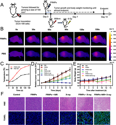 Figure 7 Therapeutic efficacy of FRNPs in vivo. (A) Schematic illustration of the in vivo treatment schedule. (B) Representative infrared thermal images of tumor-bearing mice injected with PBS or 100 μL 0.5 mg/mL FRNPs during laser irradiation. 808 nm laser was applied 12 h after injection FRNPs at a power density of 0.5 W/cm2 for 150 s. (C) The temperature change curves of tumors during 150 s laser irradiation. (D) Relative tumor volume growth curves of mice after various treatments. (E) Body weight of mice in each treatment group (n=5). (F) H&E (scale bar = 100 µm) and TUNEL (scale bar = 20 µm) stained tumor images of different groups at the 14th day after various treatments.