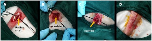 Figure 9 Surgery process of the rabbit model.Notes: (A) Longitudinal incision was made at the radius of the anterior limb to expose the radius under general anesthesia. (B) A radius osteotomy of 1.5 cm length was performed in the middle shaft of the radius and the ulna was retained to avoid the fracture of limb. (C) The Sa B-CS/HA scaffolds or CS/HA scaffolds were imbedded into the defect site. (D) All incisions were closed using nonabsorbable sutures.