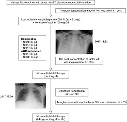 Figure 3 Process flow for treating our patient.