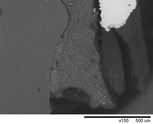 Figure 10. SEM image of the cross section of sample e, revealing the restoration (bright)-cement-tooth (dark) interfaces and the presence of excess cement on the tooth surface outside the marginal end.