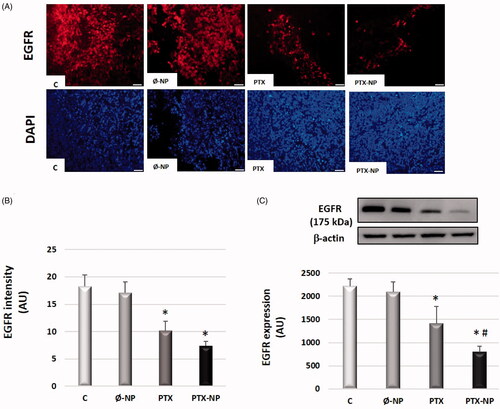 Figure 3. PTX-NP downregulates EGFR expression in the HNSCC model. (A) Fluorescence micrographs of representative immunostaining of EGFR-Alexa Fluor546 conjugate in tumor tissue (red) and 4´,6-diamidino-2-phenylindole dihydrochloride (DAPI) (blue) (x40), after treatment C (control); Ø-NP (unloaded NPs, 1 mg/ml; PTX (Paclitaxel, 5 mg/kg); and PTX-NP (Paclitaxel loaded NPs, 5 mg/kg) for 21 days. Scale bar 100 mm. (B) EGFR immunofluorescence intensity was analyzed by ImageJ software. (C) EGFR protein expression was determined by Western blotting analysis. β-actin was used as a loading control. The diagrams for EGFR (B and C) represent the mean ± SD of arbitrary units (AU). *p < .05 versus C and Ø-NP groups; #p < .05 versus group T. (n = 20).