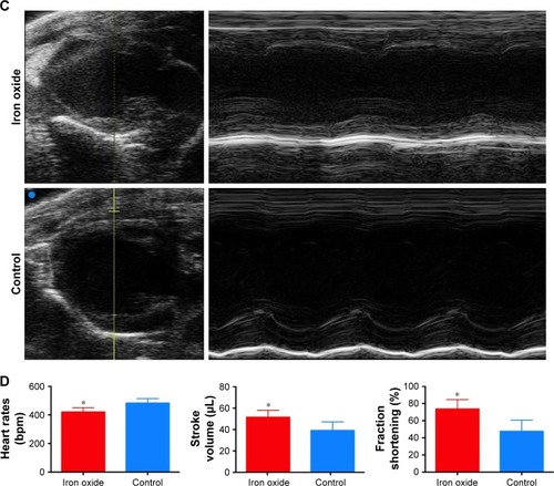 Figure 5 Evaluation of the effect of DATS-MIONs on myocardial protection.Notes: (A) Proliferation of embryonic cardiomyocyte H9C2 cells incubated with different concentrations of DATS-MIONs as monitored on a real-time cell analyzer. (B) TUNEL assay of myocardial tissues harvested from treated (iron oxide, top) and untreated (control, bottom) mice with IR-induced heart injury. Apoptotic cells were stained positive in the assay and highlighted by the red fluorescence that they emitted. (C) Representative echocardiograms of a mouse with MI in which DATS-MIONs were injected and a mouse with MI as a control that did not receive any treatment. (D) Column charts comparing the heart rate, ejection fraction, and fraction shortening of the three abovementioned murine models. Bars represent standard error of mean. *P<0.05.Abbreviations: DATS, diallyl trisulfide; IR, ischemia–reperfusion; MI, myocardial infarction; MIONs, mesoporous iron oxide nanoparticles.