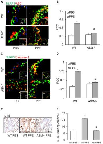 Figure 5 Inhibition of NLRP3 inflammasome formation and activation in acid sphingomyelinase (ASM) gene knockout mice receiving PPE instillation. Representative photomicrographs depicts NLPR3 colocalization with (A) ASC or (C) caspase-1. (B and D) Summarized data in the bar graph shows PCC. (E) Representative images depicts IL-1β immunostaining in the lung. (F) Summarized data shows IL-1β levels in different treatment groups. (n=6). *P<0.05 vs WT mice with PBS treatment. #P<0.05 vs WT mice with PPE treatment.