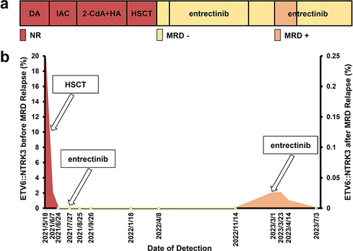 Figure 1 The treatment strategy and evaluation of this patient: (a) The patient received no response after three cycles of traditional treatments. The patient obtained the first complete response to HSCT, then survived with ETV6::NTRK3 negative after entrectinib maintenance treatment; (b) RNA sequencing regularly monitored quantification of ETV6::NTRK3.