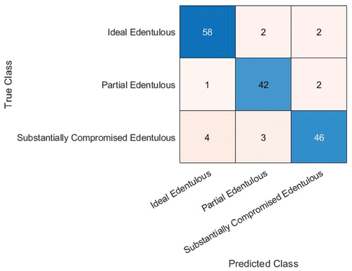 Figure 16. Confusion matrix for SqueezeNet (with data augmentation) with an accuracy of 91%.