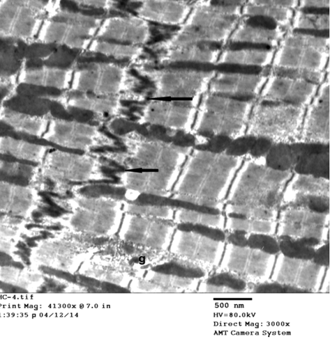 Figure 4. Electromicrograph of the control rat left ventricle showing, normal striation pattern, normal cellular features, and step wise intact intercalated disc. (Uranyl acetate/lead citrate stain).