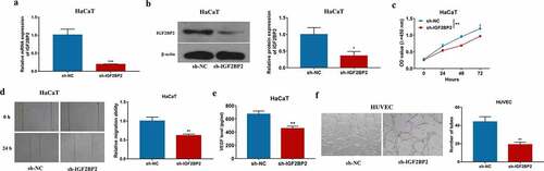 Figure 2. The influence of IGF2BP2 on HaCaT cell proliferation, migration and angiogenesis. (a and b) qRT-PCR and western blotting for IGF2BP2 expression in HaCaT cells with transfection of sh-NC or sh-IGF2BP2. (c) CCK-8 assay for proliferation of HaCaT cells transfected with sh-NC or sh-IGF2BP2. (d) Wound healing analysis for migration of HaCaT cells with transfection of sh-NC or sh-IGF2BP2. (e) ELISA for VEGF level in HaCaT cells transfected with sh-NC or sh-IGF2BP2. (f) Tube formation assay for angiogenesis of HUVEC cells co-cultured with HaCaT cells transfected with sh-NC or sh-IGF2BP2. *p < 0.05, **p < 0.01, ***p < 0.001