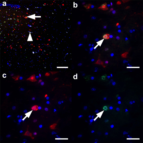 Figure 6. Co-localization of NS1 and M1 antigens in the brain tissues of H7N1 inoculated turkeys.