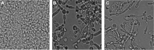 Figure S2 Antibiofilm activity of AmB–PGA nanoparticles analyzed by phase contrast microscopy. Candida biofilm was subjected to AmB–PGA and AmB-D, and phase contrast images were captured after 24 hours.Notes: (A) Candida biofilm + no treatment as control. (B) Candida biofilm + treatment with AmB-D. (C) Candida biofilm + treatment with AmB–PGA nanoparticles.Abbreviations: AmB, amphotericin B; PGA, polyglutamic acid; AmB-D, Fungizone®.