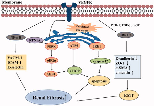 Figure 1. Pro-fibrotic effects of VEGF in chronic kidney disease. VEGF promotes the expression of VCAM-1, ICAM-1, and E-selectin through activation of the NF-κB signaling pathway. Persistent ER stress can initiate CHOP and caspase-12 apoptosis signaling pathway via three UPR branches: PERK-eIF2α-ATF4, IRE1, and ATF6 signaling pathways, eventually resulting in renal fibrosis. In turn, PERK also stimulates VEGF/VEGFR system. VEGF synergizes with PTHrP, TGF-β, and EGF in activating ERK1/2, thus promoting EMT that is related to renal fibrosis. (Abbreviations: VEGF, vascular endothelial growth factor; VCAM-1, vascular cell adhesion molecule-1; ICAM-1, intercellular adhesion molecule-1; ER, endoplasmic reticulum; UPR, unfolded protein response; VEGFR, vascular endothelial growth factor receptor; PTHrP, parathyroid hormone-related protein; TGF-β, transforming growth factor-β; EGF, epidermal growth factor; EMT, epithelial-to-mesenchymal transition; ZO-1, zonula occludens-1; α-SMA, α smooth muscle actin).