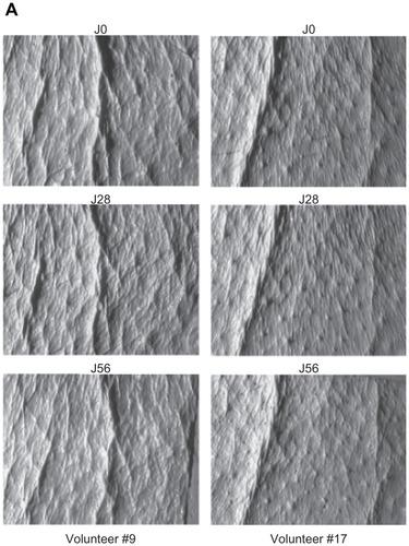 Figure 3A Antiwrinkle effect of a cream containing 1% of honokiol.Note: Observations taken for two typical volunteers (number 9 to the left, and number 17 to the right) at start (day 0), halfway (day 28), and study end (day 56).