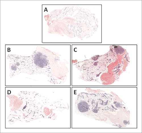 Figure 3. Mammary lesion and tumor development was minimized by 0.2% quercetin in the thoracic mammary gland of C3(1)/SV40Tag mice. Thoracic mammary glands were fixed in formalin, embedded and then sectioned for H&E staining. Images were capture using the DAKO Chromavision Systems ACIS 3 system (20× magnification). Glands from FVB/N mice (A), C3-Con (B), C3-2% (C), C3(1)-0.2% (D) and C3(1)-0.02% (E) treated mice are presented. Large areas of invasive carcinoma as well as advanced lesion formation appear blue in these sections.