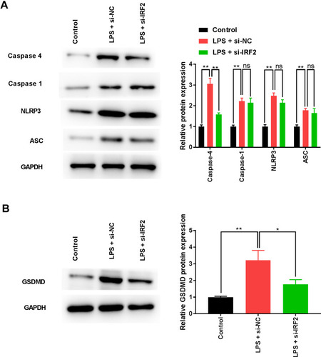 Figure 4 IRF2 knockdown inhibits LPS-induced pyroptosis. (A) The expression of caspase-1, caspase-4, NLRP3, and ASC was measured by Western blotting. (B) The expression of GSDMD was detected by Western blotting. Data were expressed as mean + SD. *p<0.05, **p<0.01.