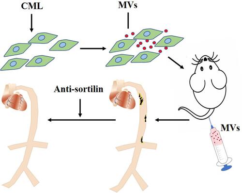 Figure 8 CML-induced SMCs-derived MVs promoting calcification may be achieved by Sortilin. CML induced SMCs to secrete MVs. After injecting these MVs into apoE-/- mice through the tail vein, the aorta of the mice was obviously calcified. The treatment of Anti-sortilin may reverse this process.Abbreviations: CML, Nε-Carboxymethyl-lysine; MVs, matrix vesicles; SMCs, smooth muscle cells.