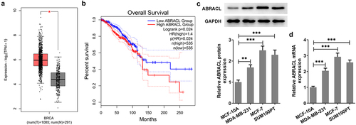 Figure 1. ABRACL is highly expressed in breast cancer tissues and cell lines. (a-b) ABRACL expression in breast cancer tissues and the overall survival as showed in GEPIA2. (c-d) ABRACL mRNA and protein expression in breast cancer cell lines was examined with the use of western blot and RT-qPCR. **P < 0.01, ***P < 0.001.