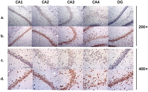 Figure 4. 8-OHdG immunohistochemistry staining of hippocampus in two groups. a, sham-operated group (200×); b, 5/6 nephrectomy group (200×); c, sham-operated group (400×); d, 5/6 nephrectomy group (400×). CA1-CA4, the CA1-CA4 region of hippocampal gyrus; DG, dentate gyrus.