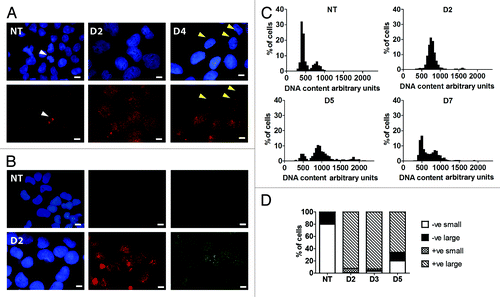 Figure 1. DNA damage response of PA-1 cells to ETO treatment. PA-1 cells were treated with 8 µM ETO for 20 h, then washed and assessed at the indicated time point. Cells were pelleted, cytospun, fixed and stained for (A) pCHK2 (red) or (B) γH2AX (red) and RAD51 (green) in combination with DAPI (blue). Bar = 10 µM. (A) NT PA-1 cells show very faint background pCHK2 staining in non-dividing cells and increased staining of centrosomes in dividing cells (white arrowheads). On day 2 post-ETO, small pCHK2-positive foci accumulate in the nuclei of all cells. By day 4, some small nuclei have lost pCHK2 staining (yellow arrowheads), while large cells remain pCHK2 positive. (B) NT PA-1 cells show no positive staining for γH2AX or RAD51. On day 2, the majority of cells show accumulation of γH2AX or RAD51 positive foci in the nuclei. (C) Cells were cytospun, fixed and stained for DNA image cytometry. DNA content was determined for at least 200 cells in each condition and represented as a percentage. Profound G2 arrest on day 2 was observed followed by the simultaneous emergence of a polyploid (> 4C) and G1 fraction on day 5 before the recovery of the normal cell cycle profile by day 7. (D) The proportion of pCHK2-positive cells was examined in the context of DNA content with cells sub-divided into small or large cells. In the NT control sample, all were pCHK2-negative with an expected nuclei size distribution (2C 80%; ≥ 4C 20%). On day 2, all cells were pCHK2-positive and the vast majority of nuclei were large (≥ 4C). By day 5, cells with small nuclei appear, all of which are pCHK2-negative. Data are representative of > three independent experiments.