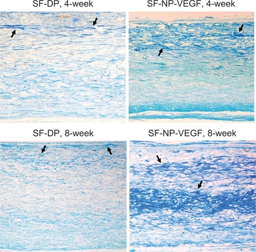 Figure 10 Glycosaminoglycans (GAG) staining. Scott’s alcian blue staining showed that GAGs were present in all layers of the wall, original magnification × 100. More blue staining (new collagen fibrils) was observed in SF-NP-VEGF implant at 4 and 8 week.Note: The arrows indicate positive staining of new collagen fibrils.Abbreviations: DP, decellularized scaffolds; NP, nanoparticle; SF, scaffolds; VEGF, vascular endothelial growth factor