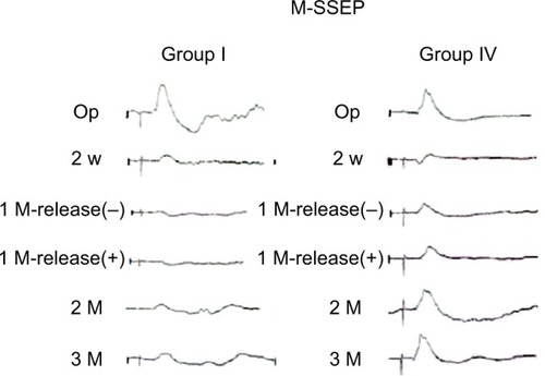 Figure 1 Representative compression–decompression tracings of M-SSEP of STZ-induced diabetic rats (group I) and nondiabetic rats (group IV). Note that the amplitude improved in both groups but was more significant in group IV.